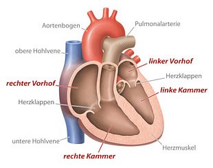 Kardiomyopathie in schematsicher Darstellungs des menschlichen Herzen